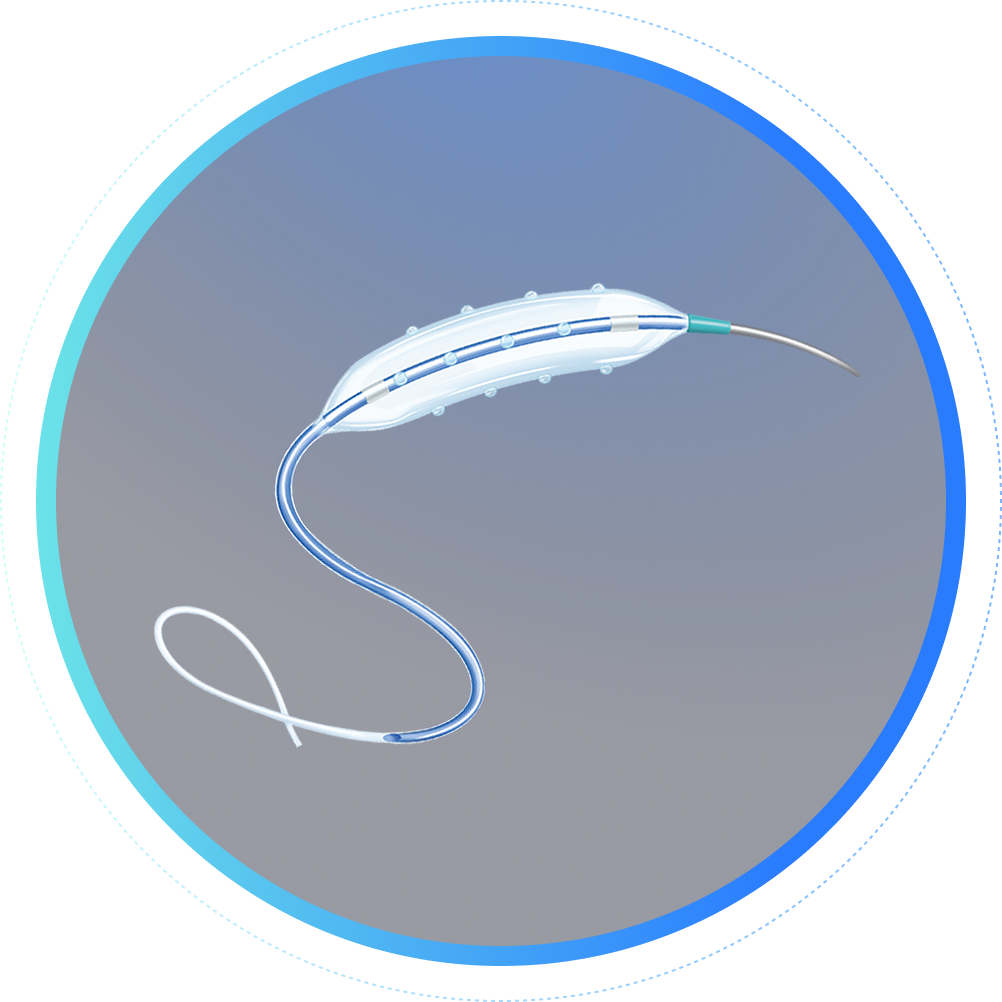 Coronary Intervention